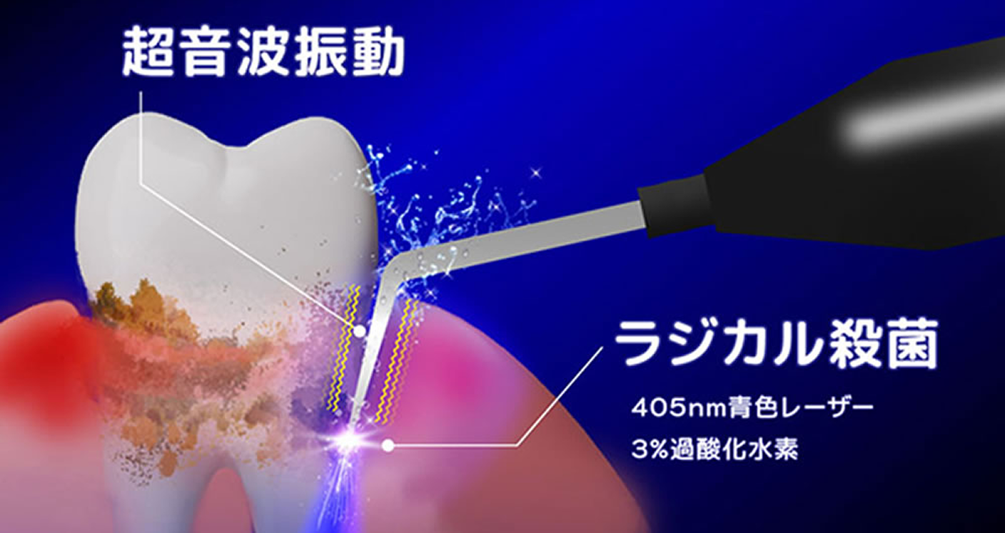 歯周外科処置を回避できる。